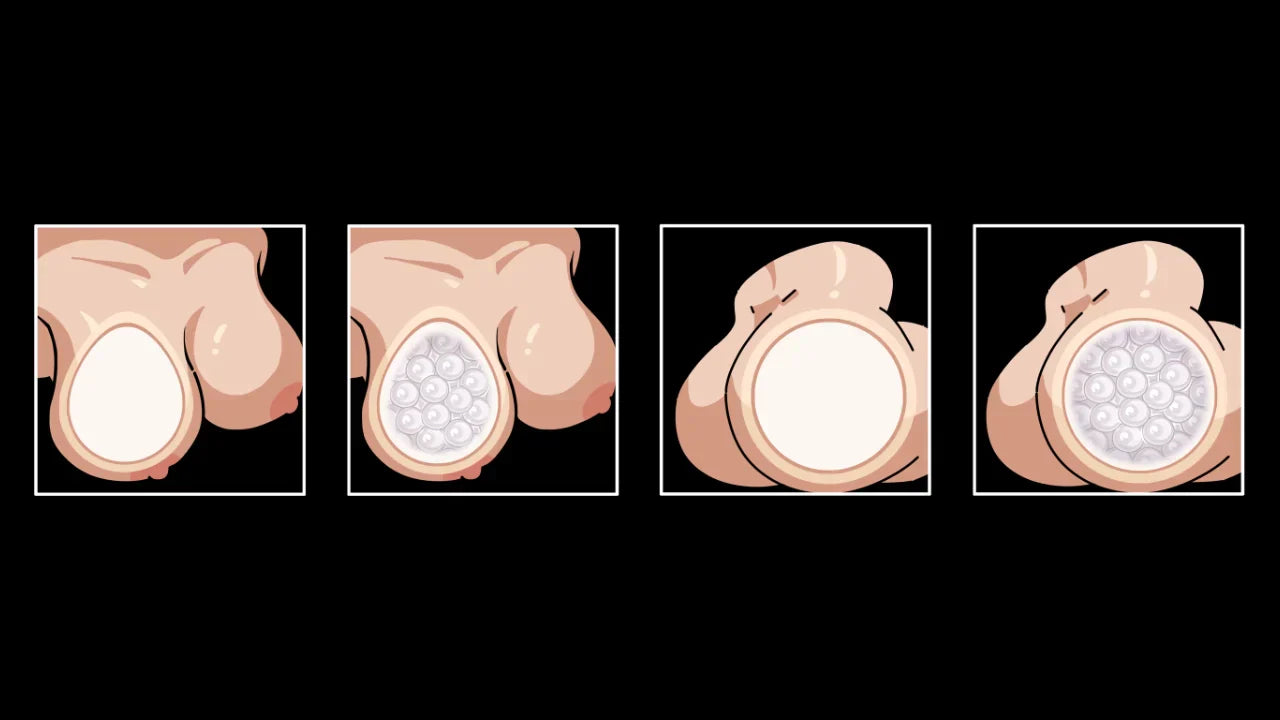 Image of Soft Tissue Layering Explained: The Foundation of Realistic Silicone Body Design